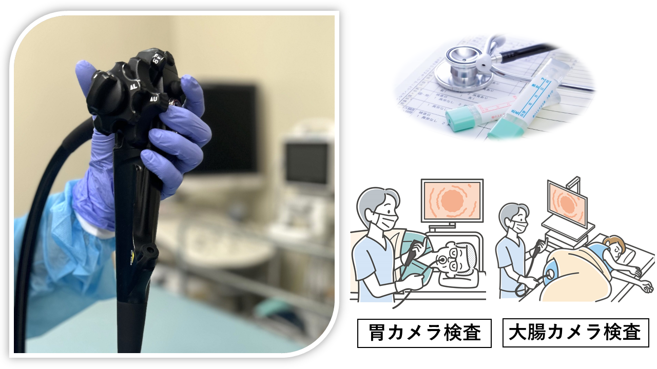 内視鏡検査などがんを中心とした病気の早期発見、治療